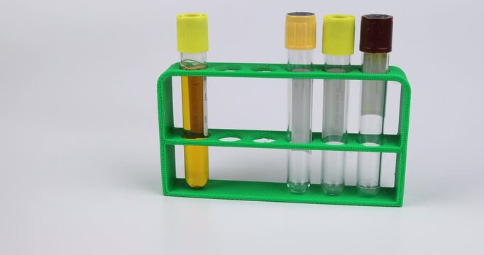 A laboratory technician hand is placing and removing glass vacuum tubes in a green plastic holder rack to complete all the medical urine samples.