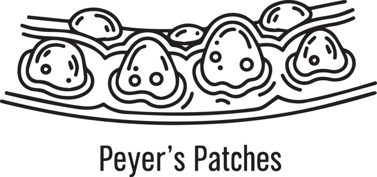 Medical illustration, Peyer patches, lymphoid follicles, gut, anatomy, vector graphics