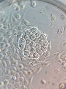 A microscopic image reveals a cluster of mouse embryonic cells, specifically morula cells, arranged in a compact, spherical formation.