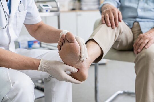 Woman doctor examining elderly man foot ulcer. Treating diabetic wound on heel. Medical healthcare concept for geriatric care