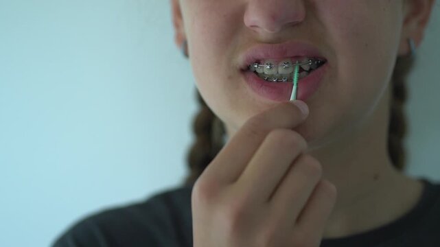 A teenage girl uses an interdental brush to clean between her braces at home, demonstrating proper oral hygiene and orthodontic care. Dental care product ads, orthodontic clinic brochures, teenage