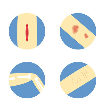 Skin injury types flat icon set vector illustration. Open cut wound burn bone fracture and scratches templates on blue circle background. Medical traumatology design elements.