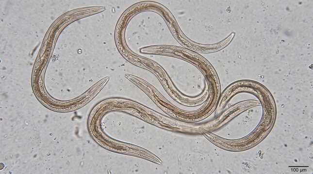 Microscopic view of nematodes, small parasitic worms, under a microscope.
