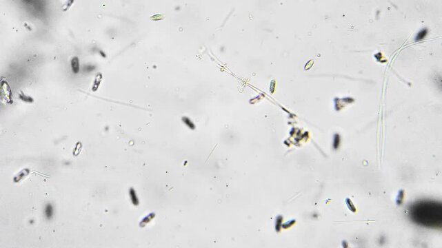 Highdetail visualization of microbes. Closeup imaging of motile microorganisms structure. Magnified observations revealing microbial movement and morphological characteristics in detail