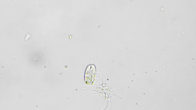 Protist movement highlighted. Single celled organism demonstrating swimming in pond water sample. Microscopic protist displaying flagella motion and intracellular nucleus in pond environment