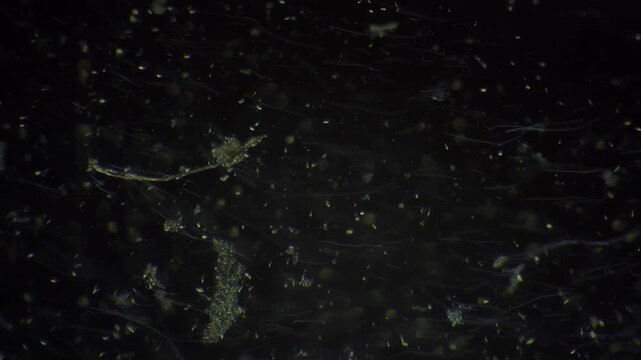 Dark pond microscope view showing drifting algae and motile cells under low light, detailed biofilm fragments and suspended particles captured for scientific observation and microbiome study