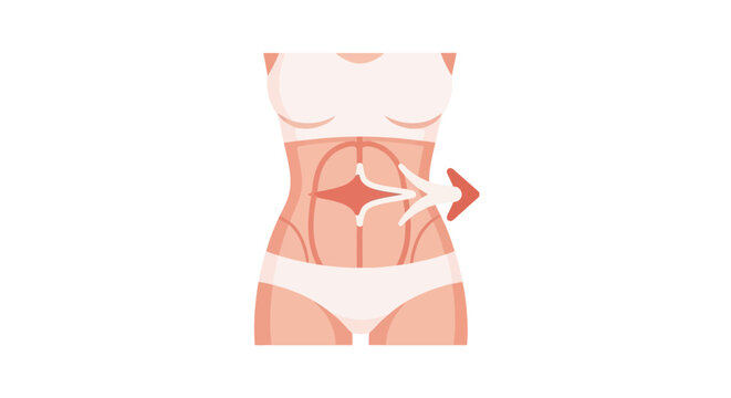 Woman's toned abs illustration with arrow pointing to belly button, body contouring concept