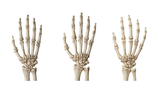 Three human hand skeletons showing skeletal anatomy against white background with skeleton skeletal research structure educational orthopedic clinical diagnostic radiology