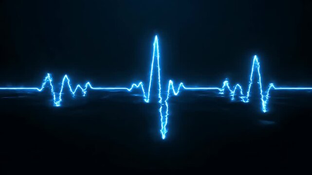 Electrocardiogram heart rhythm monitor tracing.