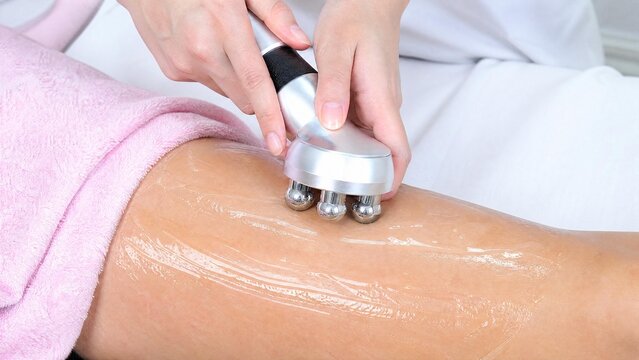 RF Body Contouring and Anti-Cellulite Treatment on Female Leg