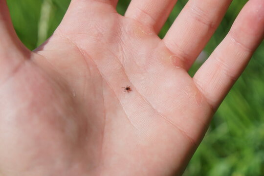 Macro shot of a tiny parasitic tick on skin of human hand. Sharp macro photograph of an ixodes ricinus tick on a person's open palm. Clear view of the parasite before biting or blood sucking.