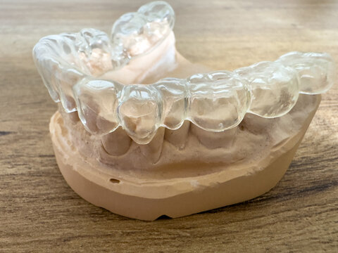 Dental splint for bruxism therapy and protection against teeth grinding