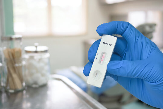 Ebola Rapid Antigen Diagnostic Test Positive, A technician's blue-gloved hand holds a rapid Ebola Ag antigen test cassette showing a positive result inside a hospital clinic room