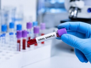 Naklejka premium Scientist holding test tube with viral sample in laboratory. Medical professional analyzing red blood collected for disease diagnosis. Researching global outbreak, pandemic and health crisis.