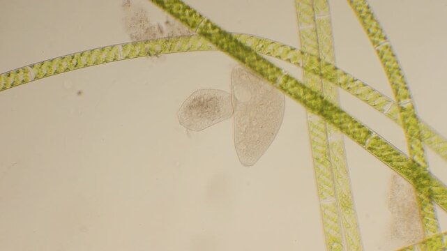 ciliate and green algae, microscopy, microrganism, water, ciliata, algae, microscopic, Monza, Italy