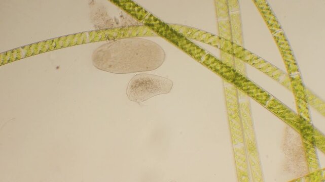 ciliate and green algae, microscopy, microrganism, water, ciliata, algae, microscopic, Monza, Italy