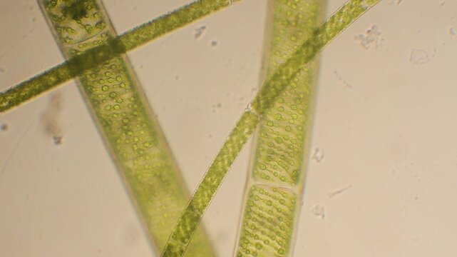 green algae under the microscope, green algae, cloroplasts, microscope, Monza, Italy