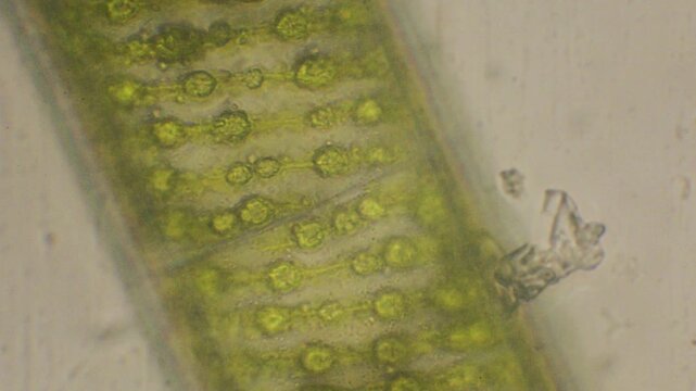green algae under the microscope, green algae, cloroplasts, microscope, Monza, Italy
