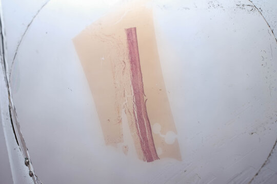  Peripheral Nerve Longitudinal Section Myelin Sheath Histology