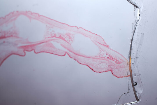 Human Finger Longitudinal Section Nail Skin Bone Histology S