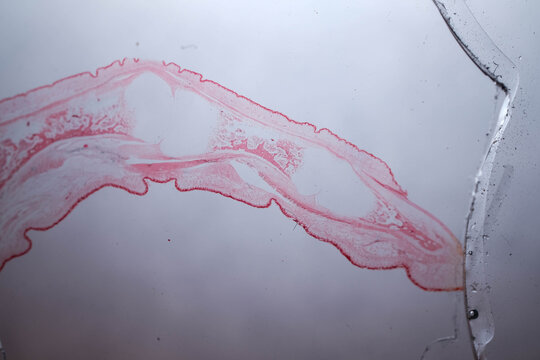 Human Finger Longitudinal Section Nail Skin Bone Histology S
