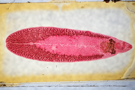 Fasciola Hepatica Adult Liver Fluke Stained Whole Mount