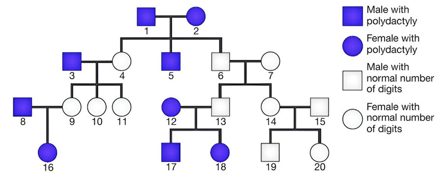 Pedigree chart of polydactyly transmission.
