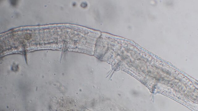 nematode,  roundworms, phylum Nematoda,  Nemathelminthes,  plant-parasitic nematodes,  eelworms, microscope, root parasite,  Monza, Lambro Valley regional park, Monza, microscope