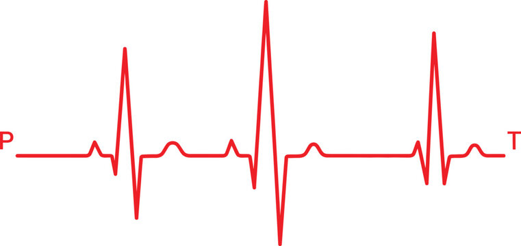Red heart rate monitor pulse line showing normal human heartbeat rhythm