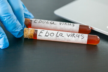 Fototapeta premium close up view of two glass test tubes labeled ebola virus filled with blood samples on a dark desk with blurred scientist hands in blue medical gloves typing on a laptop keyboard