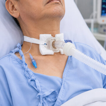 Tracheostomy tube