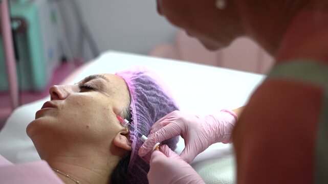 Cosmetologist administering facial pdo thread lift injection