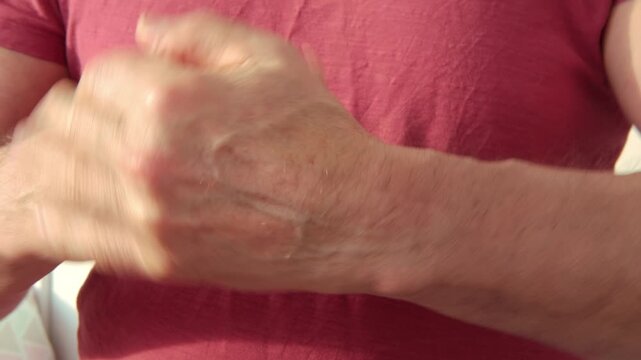 Close up of male hands with dry skin damage. Dermatology concept human hands with skin with cracks and wounds, care anti-aging procedures, age-related skin changes