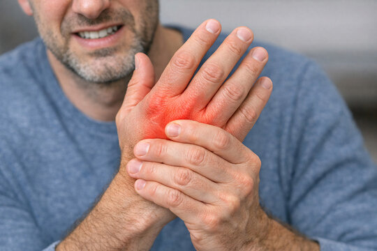 Man massaging his injured hand