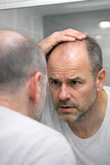 Fototapeta premium Man gazes at thinning hair in mirror