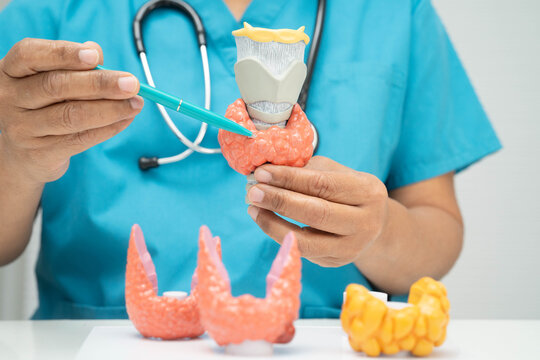 Hyperthyroidism, Overactive Thyroid, Thyroid Lymphoma, Asian doctor with thyroid gland human anatomy model in hospital.
