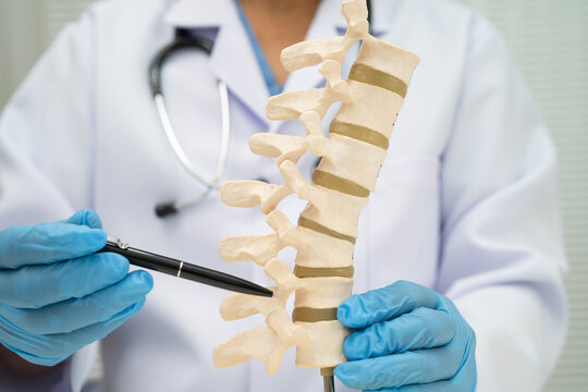 Asian doctor holding spinal nerve and bone model, Lumbar spine displaced herniated disc fragment for treatment medical in the orthopedic department.