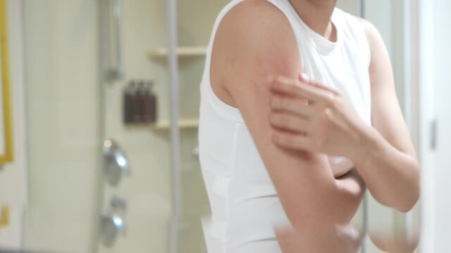 skin problem and beauty. woman scratch body has itchy skin from skin allergic, steroid allergy, sensitive skin, red from sunburn, chemical allergy, rash, insect bites, Seborrheic Dermatitis.