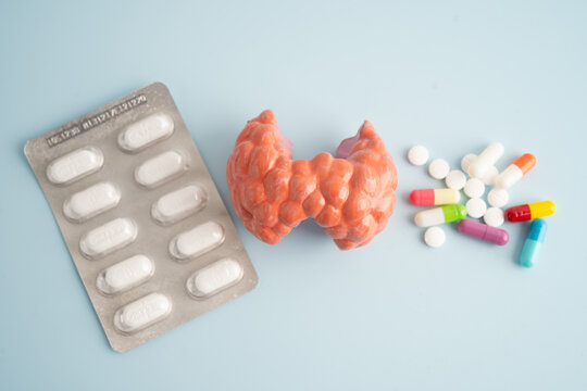 Thyroid model with pill drug treatment, Hyperthyroidism, Overactive or Lymphoma.