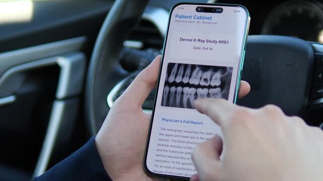 Viewing a Dental X-Ray study on a smartphone inside a car. The screen displays a radiograph of the upper and lower jaw with a physician's report. Perfect for telemedicine, digital dentistry, and