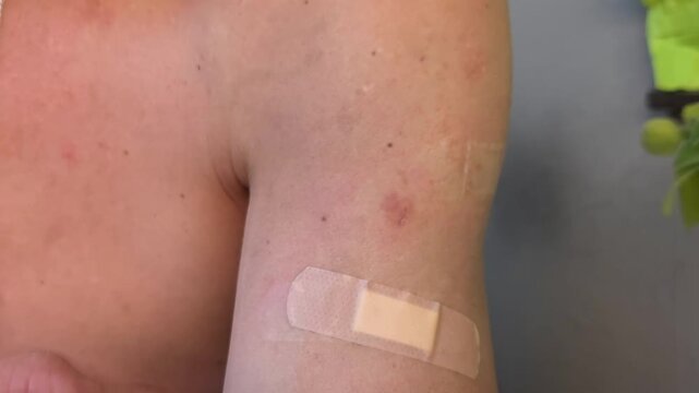 Man applying adhesive bandage on his arm after vaccination. Healthcare procedure with plaster for skin protection. Medical treatment for wound or injection site.