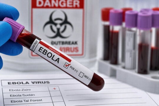 Ebola virus outbreak blood test diagnosis concept showing contagious viral infection deadly pathogen PCR rapid test Ebola awareness epidemic spread public health emergency response