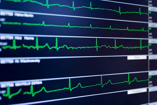 Close-up of EKG screen display