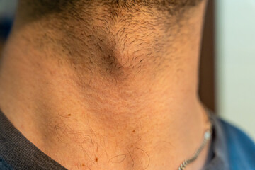 Fototapeta premium Close-up view of male neck with short hair and light skin tone, showcasing an unshaved appearance, suitable for beauty and grooming concepts