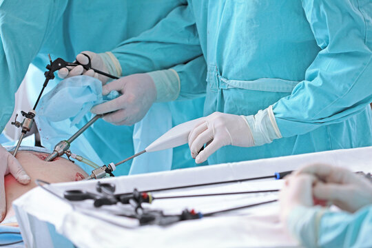 Modern laparoscopic surgery. Surgical intervention through small holes. Laparoscopy in surgery.Team of surgeons. Laparoscopic instruments. Hands in protective gloves
