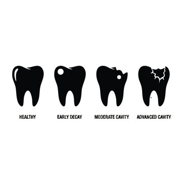 Tooth decay progression stages from healthy to cavity icon.