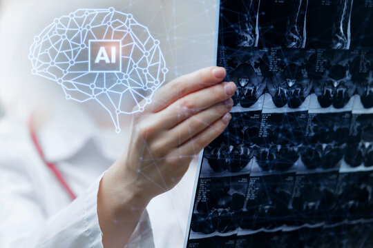 Female doctor with ai assistant brain overlay inspecting mri radiology scans for diagnostic analysis and medical technology