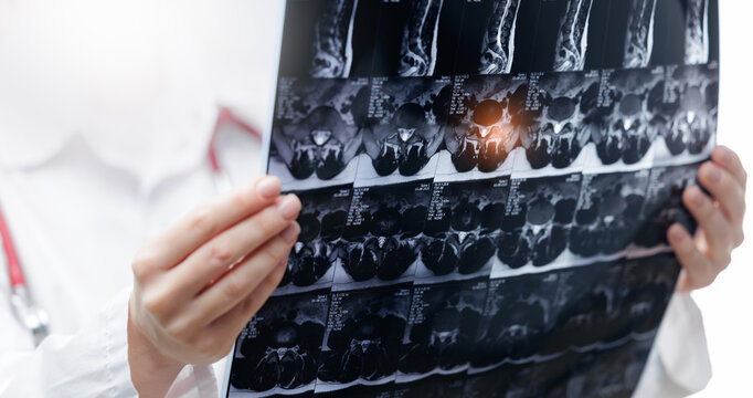 Closeup doctor holding radiology xray film of spine for medical analysis and diagnostic report background for clinic and healthcare design
