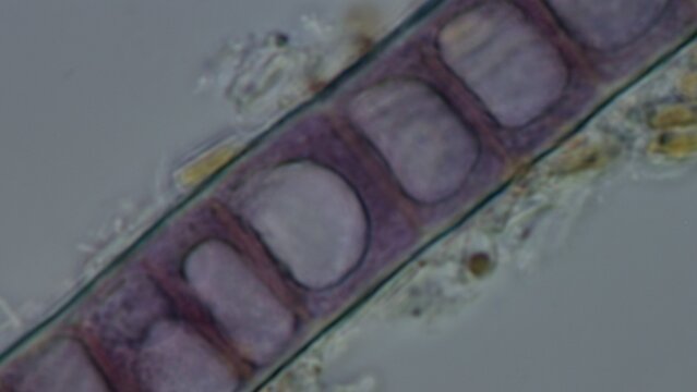 Bangia sp. red algae cells at 100x brightfield microscopy