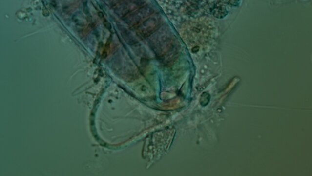 Bangia sp. red algae filament cells at 50x Nomarski DIC